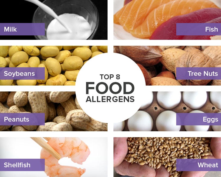 Everything You Should Know About Food Allergies | Big 8