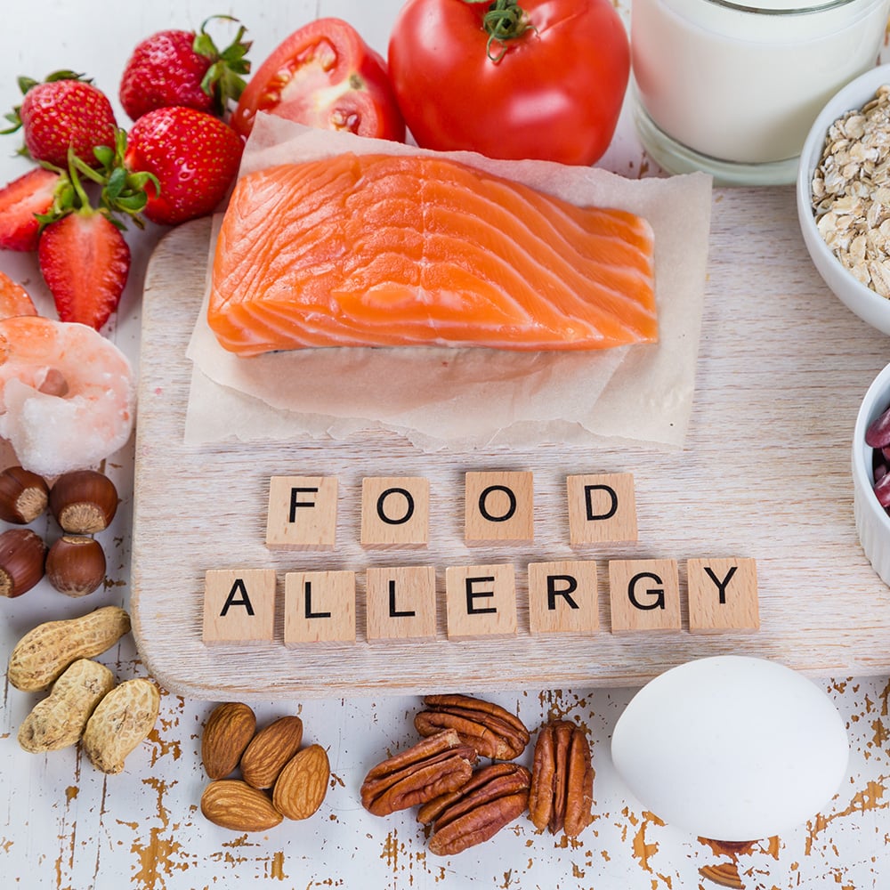 the big 8 food allergies